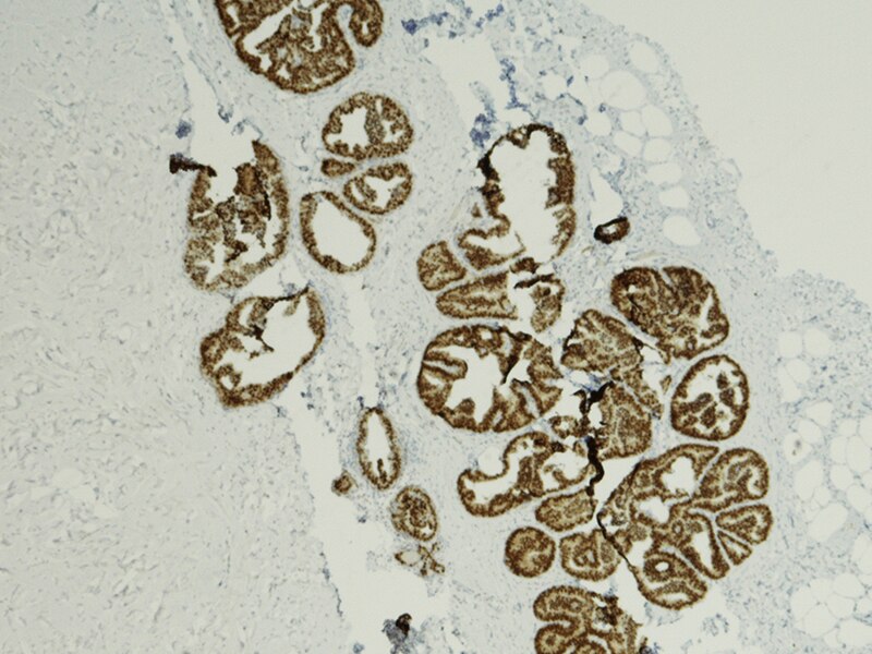 Immunohistochemistry