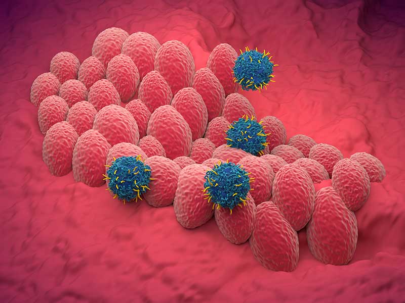 Immunotherapy