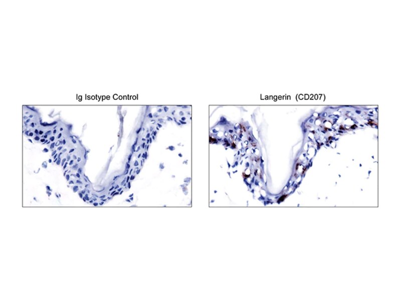 Image comparing IG Isotype Control against Langerin (CD207)