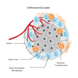Diagram showing tumor cells.