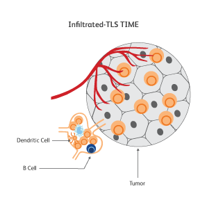 Diagram showing a dendritic cell and B cell infiltrating a tumor.