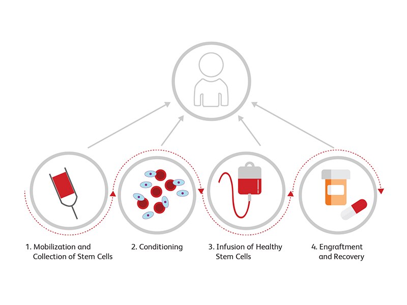 Diagram showing steps for stem cell collection and transplantation process.